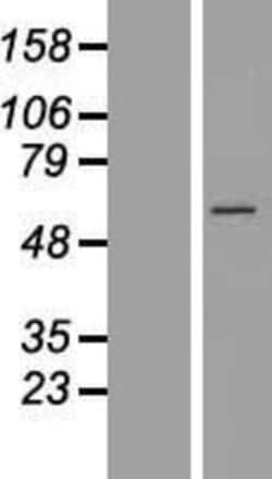 Novus Biologicals&trade;&nbsp;CCT6B Overexpression Lysate