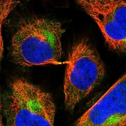 CCT8 Antibody, Novus Biologicals 25 &mu;L; Unlabeled:Antibodies, Polyclonal