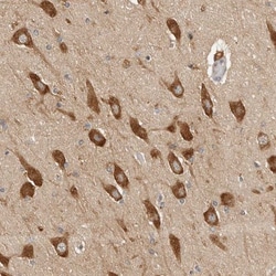 CCT8 Antibody, Novus Biologicals 25 &mu;L; Unlabeled:Antibodies, Polyclonal