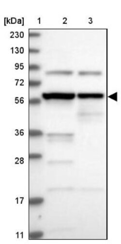 CCT8 Antibody, Novus Biologicals 25 &mu;L; Unlabeled:Antibodies, Polyclonal