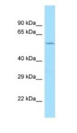 CCZ1 Antibody, Novus Biologicals 100&mu;L; Unlabeled:Antibodies, Polyclonal