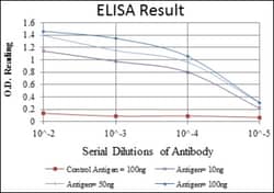 Endoglin/CD105 Antibody (3A9) - BSA Free, Novus Biologicals:Antibodies:Primary