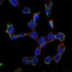 Endoglin/CD105 Antibody (3A9) - BSA Free, Novus Biologicals:Antibodies:Primary