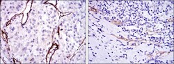 Endoglin/CD105 Antibody (3A9) - BSA Free, Novus Biologicals:Antibodies:Primary