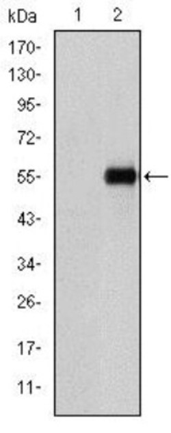 Endoglin/CD105 Antibody (3A9) - BSA Free, Novus Biologicals:Antibodies:Primary
