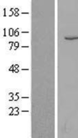 Novus Biologicals&trade;&nbsp;Neprilysin/CD10 Overexpression Lysate