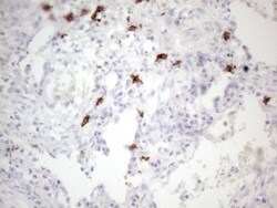 CD117/c-kit Antibody (OTI2B12), Novus Biologicals 0.1mL; Unlabeled:Antibodies,