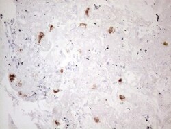 CD117/c-kit Antibody (OTI2B12), Novus Biologicals 0.1mL; Unlabeled:Antibodies,