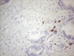 CD117/c-kit Antibody (OTI2B12), Novus Biologicals 0.1mL; Unlabeled:Antibodies,