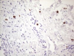 CD117/c-kit Antibody (OTI2B12), Novus Biologicals 0.1mL; Unlabeled:Antibodies,