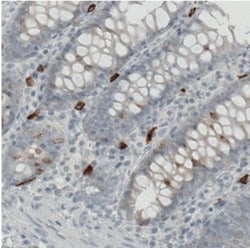 CD117/c-kit Antibody (CL1667), Novus Biologicals:Antibodies:Primary Antibodies
