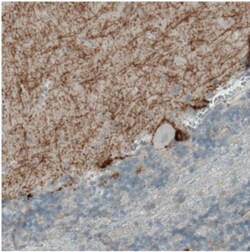 CD117/c-kit Antibody (CL1667), Novus Biologicals:Antibodies:Primary Antibodies
