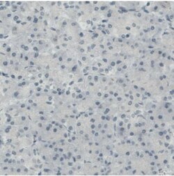 CD117/c-kit Antibody (CL1667), Novus Biologicals:Antibodies:Primary Antibodies
