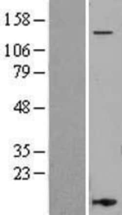 Novus Biologicals&trade;&nbsp;Integrin alpha L/CD11a Overexpression Lysate
