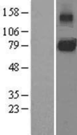 Novus Biologicals&trade;&nbsp;gp130/CD130 Overexpression Lysate