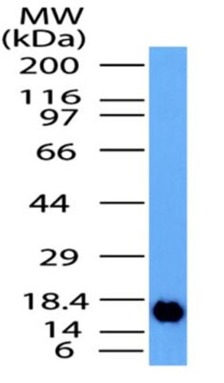 4-1BB/TNFRSF9/CD137 Antibody, Novus Biologicals:Antibodies:Primary Antibodies