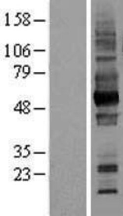 Novus Biologicals™ EMMPRIN/CD147 Overexpression Lysate