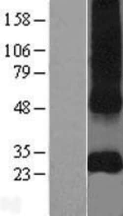Novus Biologicals&trade;&nbsp;CD151 Overexpression Lysate