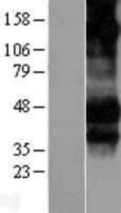 Novus Biologicals&trade;&nbsp;Fc gamma RIIIA/CD16a Overexpression Lysate
