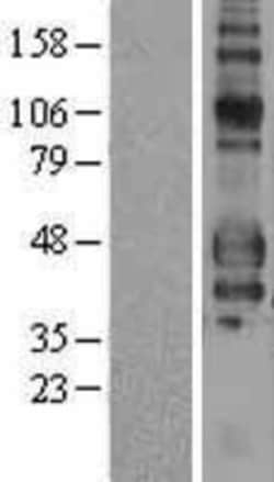 Novus Biologicals&trade;&nbsp;Fc gamma RIIIA/CD16a Overexpression Lysate