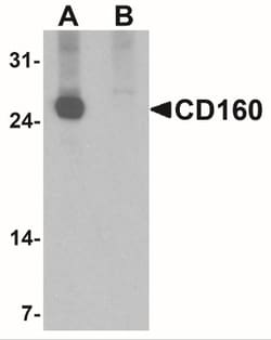 CD160 Antibody - BSA Free, Novus Biologicals 0.025 mg, Unlabeled:Antibodies,