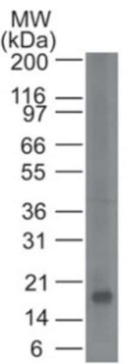 CD161 Antibody (14F2F11), Novus Biologicals:Antibodies:Primary Antibodies