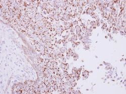 RHAMM/CD168 Antibody, Novus Biologicals 0.1mL; Unlabeled:Antibodies, Polyclonal