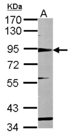 RHAMM/CD168 Antibody, Novus Biologicals 0.1mL; Unlabeled:Antibodies, Polyclonal