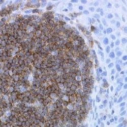 CD19 Antibody (LE-CD19) - BSA Free, Novus Biologicals 0.02mg; Unlabeled:Antibodies,