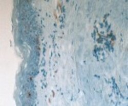 CD1a Antibody (201B5.08), Novus Biologicals 0.1mg; Unlabeled:Antibodies,