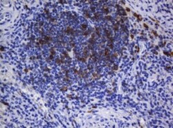 CD1c/BDCA-1 Antibody (OTI2F4), Novus Biologicals 0.1mL; Unlabeled:Antikörper