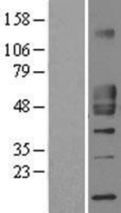 Novus Biologicals&trade;&nbsp;CD1d Overexpression Lysate