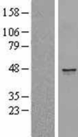 Novus Biologicals&trade;&nbsp;CD1e Overexpression Lysate