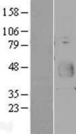 Novus Biologicals&trade;&nbsp;CD200/OX2 Overexpression Lysate