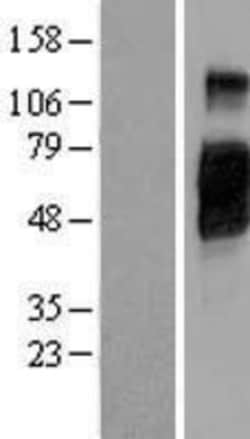 Novus Biologicals™ CD200R1 Overexpression Lysate