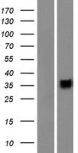 Novus Biologicals&trade;&nbsp;CD200R1L Overexpression Lysate