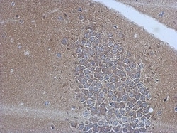 DNAM-1/CD226 Antibody, Novus Biologicals 0.1mL; Unlabeled:Antibodies, Polyclonal