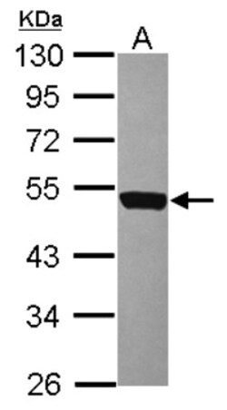 DNAM-1/CD226 Antibody, Novus Biologicals 0.1mL; Unlabeled:Antibodies, Polyclonal