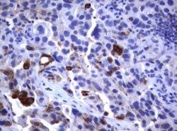 CD23/Fc epsilon RII Antibody (OTI2B6), Novus Biologicals 0.1mL; Unlabeled:Antibodies,
