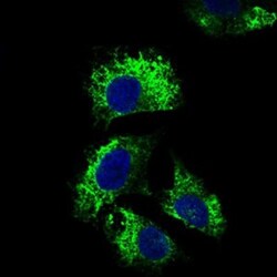 CD25/IL-2R alpha Antibody (1B5D12) - BSA Free, Novus Biologicals 0.1mL;