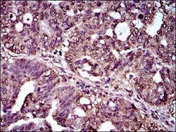CD25/IL-2R alpha Antibody (1B5D12) - BSA Free, Novus Biologicals 0.1mL;