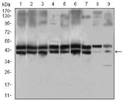 CD25/IL-2R alpha Antibody (1B5D12) - BSA Free, Novus Biologicals 0.1mL;