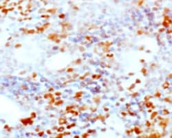 CD25/IL-2R alpha Antibody (PC61.5.3) - BSA Free, Novus Biologicals 0.25mg;