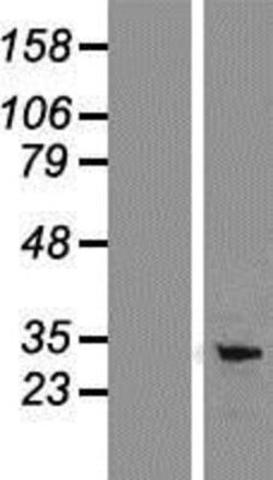 Novus Biologicals&trade;&nbsp;PD-L1 Overexpression Lysate
