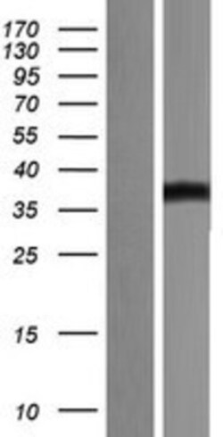 Novus Biologicals™ B7-H3/CD276 Overexpression Lysate
