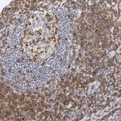 CD2 Antibody, Novus Biologicals 0.1mL; Unlabeled:Antibodies, Polyclonal