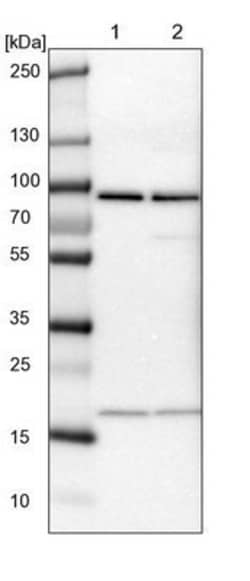 CD2AP Antibody, Novus Biologicals:Antibodies:Primary Antibodies