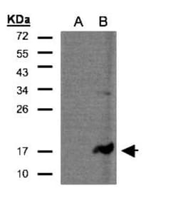 CD3 zeta Antibody, Novus Biologicals 0.1 mL | Buy Online | Novus Biologicals | Fisher Scientific