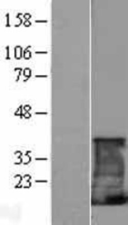 Novus Biologicals&trade;&nbsp;CD3 zeta Overexpression Lysate