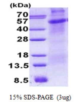 Novus Biologicals&trade;&nbsp;Recombinant Human CD30/TNFRSF8 His Protein